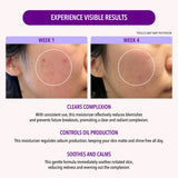 10% Niacinamide oil control moisturizer crema facial - Moira