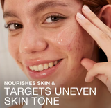 Ultra Gentle Gel hidratante facial para piel propensa al acné - Neutrogena