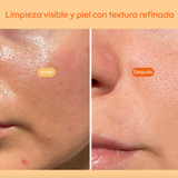 kit skincare Kiero, rutina facial Kiero, limpiador enzimático, pads tónicos, serum facial, protector solar en stick, skincare coreano, rutina completa de cuidado facial, limpieza e hidratación, protección solar diaria