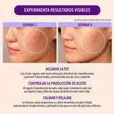 oil control serum, MOIRA, niacinamide serum, salicylic acid serum, serum para piel grasa, control de brillo, blemish care, skincare, serum hidratante, gel serum.